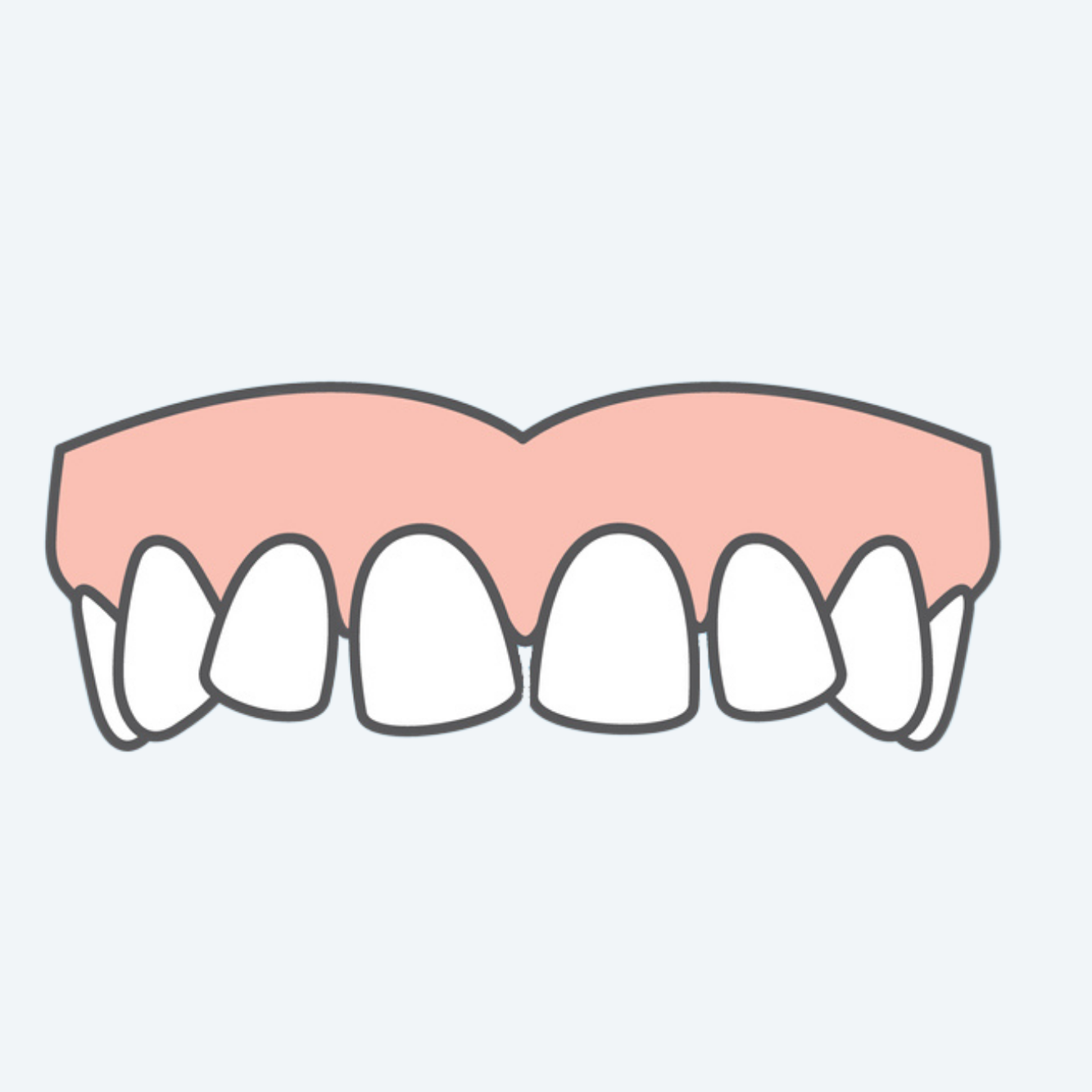 OSP - Crooked Teeth