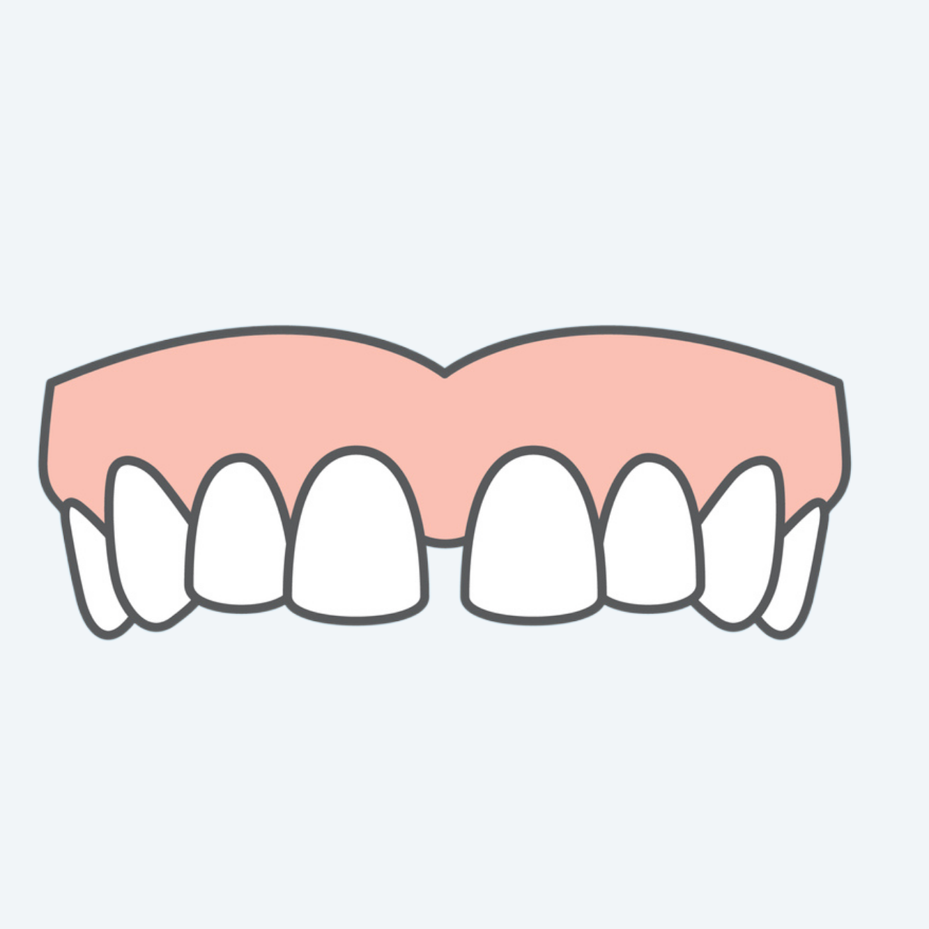 OSP - Gap Teeth